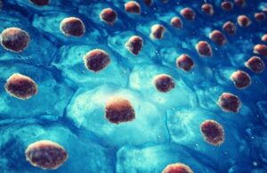 Detachable microneedle depots deliver therapeutic stem cells to injured tissue sites