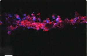 Bioconductive, neuron-growing ink offers hope for people with nerve injury