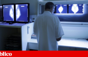 Composto químico testado em ratinhos reduz cancro da mama e metástases