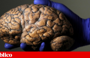 Cinco coisas surpreendentemente esperançosas que aprendemos sobre Alzheimer este ano