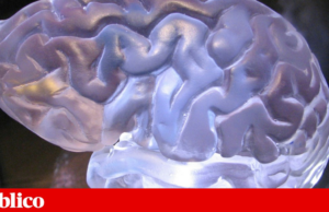 Pessoas com epilepsia são o dobro do estimado e quase metade sem seguimento médico