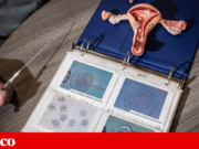 Descobertas novas pistas sobre a diminuição da fertilidade feminina com a idade