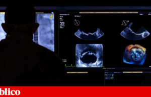 Hospital de Braga quer chegar ao final do ano a fazer cirurgias cardíacas todos os dias