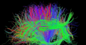 O cérebro pode sentir o cancro? Equipa da Champalimaud recebe financiamento para explorar nova fronteira da oncologia