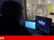 Imposto do tabaco: Pulmonale tem “muitas dúvidas” sobre as boas intenções do Governo