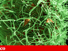 Há um novo surto de Ébola: o que é a Bundibugyo e porque é uma emergência mundial?